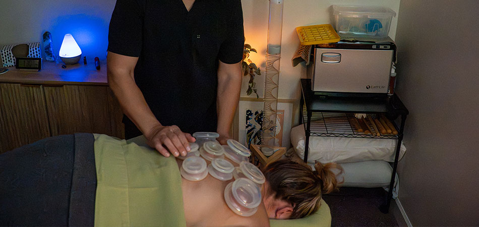 Cupping Service